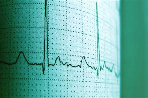 Marginal Cost-Benefit Analysis for Expenditure Analysis