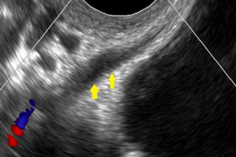 What is the Cost of an Ultrasound at a Radiology Center in Franklin, Tennessee?